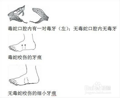 怎么辨别有毒和无毒蛇？