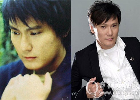 张信哲整容前后照片