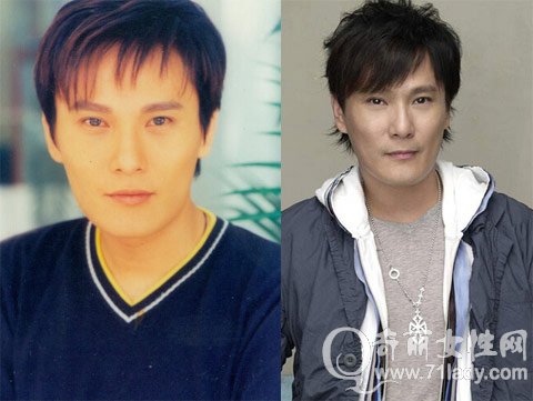 张信哲整容前后照片