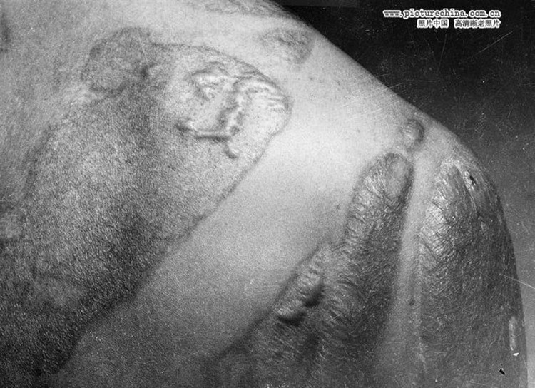 1945年广岛遭原子弹爆炸后惨状 - 刘鹏 - 凝固的历史—永恒的回忆