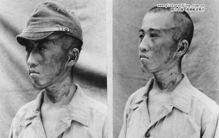 1945年广岛遭原子弹爆炸后惨状 - 刘鹏 - 凝固的历史—永恒的回忆