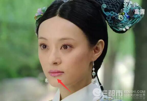 孙俪的痣