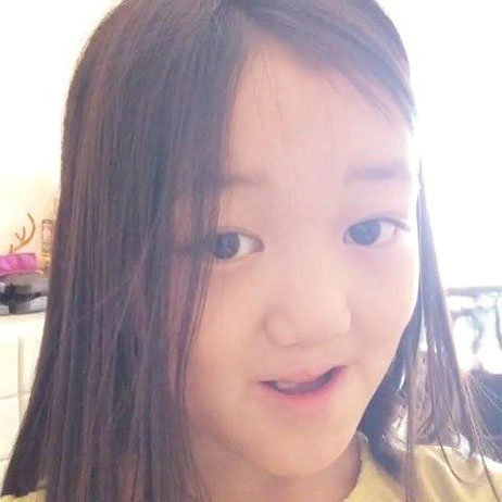 【科学姐】李嫣兔唇这事儿 真不能全怪王菲