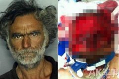 迈阿密丧尸啃脸事件真相，国外丧尸是否真的存