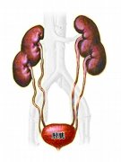 大叔做ct才知道自己有4个肾，盘点４个肾的人那